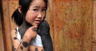 Девочка-мутант из Китая (фото)